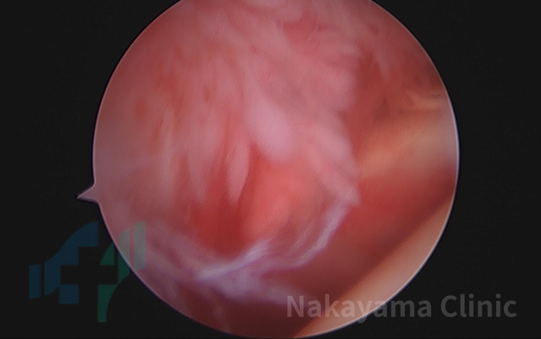 画像の説明をここに入れる