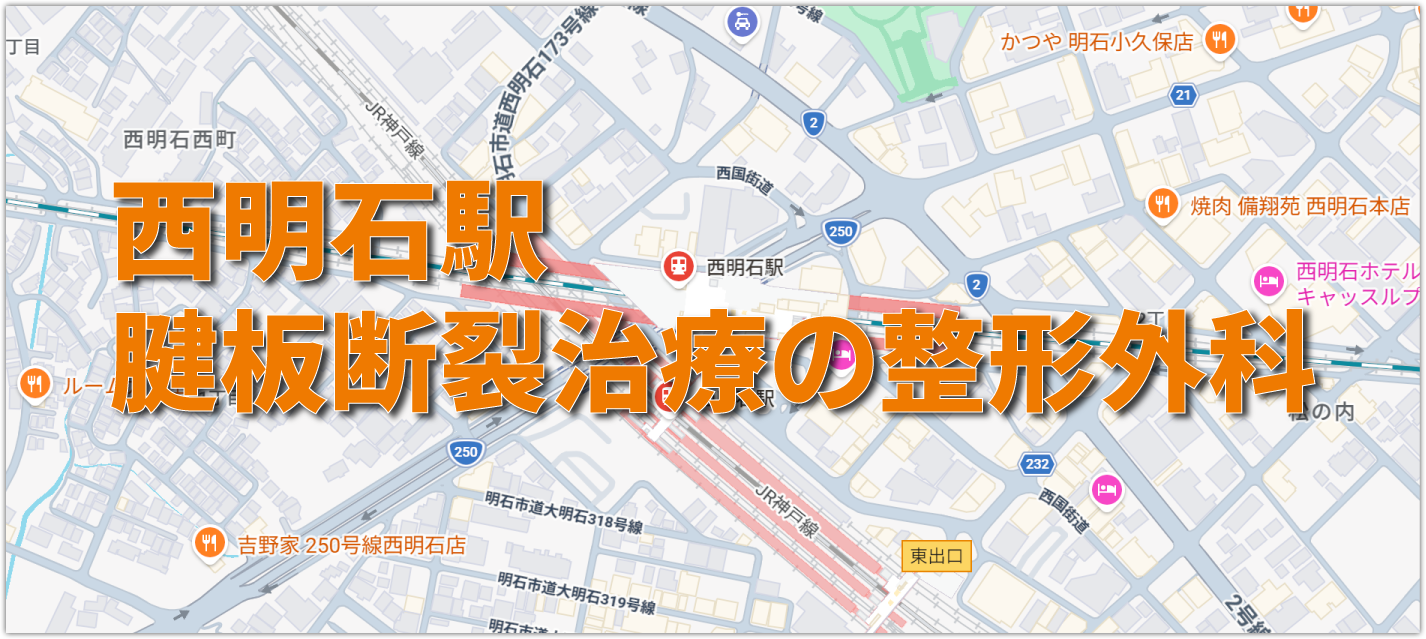 西明石駅周辺の肩の痛み「腱板断裂」を診察する整形外科クリニック
