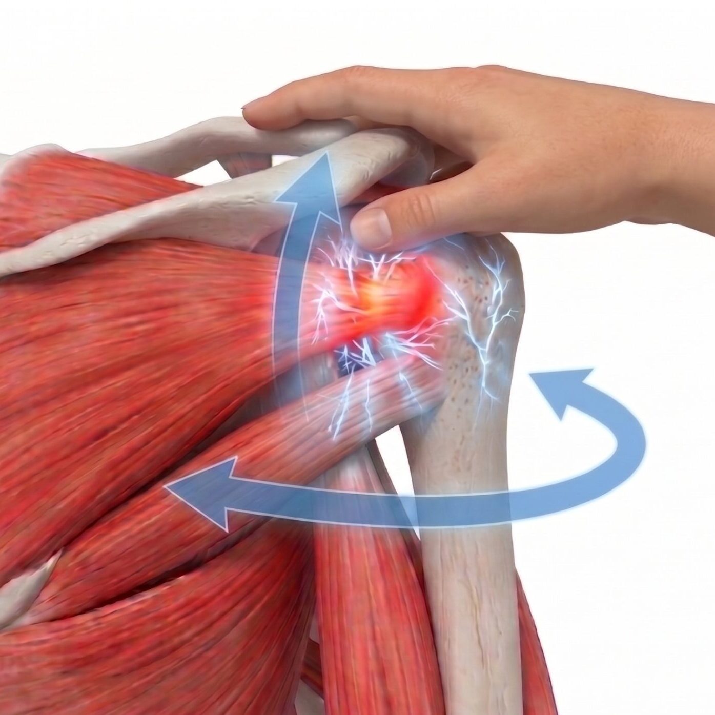 マニピュレーション
